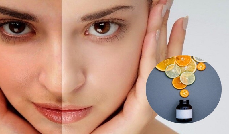 Cách Vitamin C hỗ trợ chống lão hóa da
